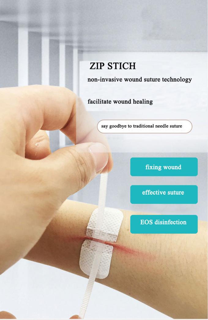 Non Invasive Zip Stitch Suture Wound Closure อุปกรณ์ปิดผิวหนัง ผ้าไม่ทอ ...