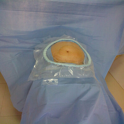 แพคชั่นผ่าตัดครั้งเดียวที่มีความซึมซึมสูง พร้อมกับเขตวิกฤตที่ซึมซึมที่เสริมและการกําจัดโรค EO สําหรับฉุกเฉินในโรงพยาบาล